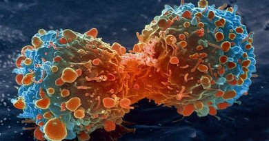 Cientista desenvolve técnica detectar câncer sem sintomas