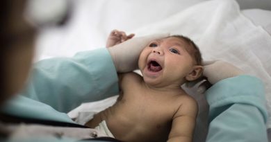 Ministério Saúde Brasil 1,6 mil bebês microcefalia